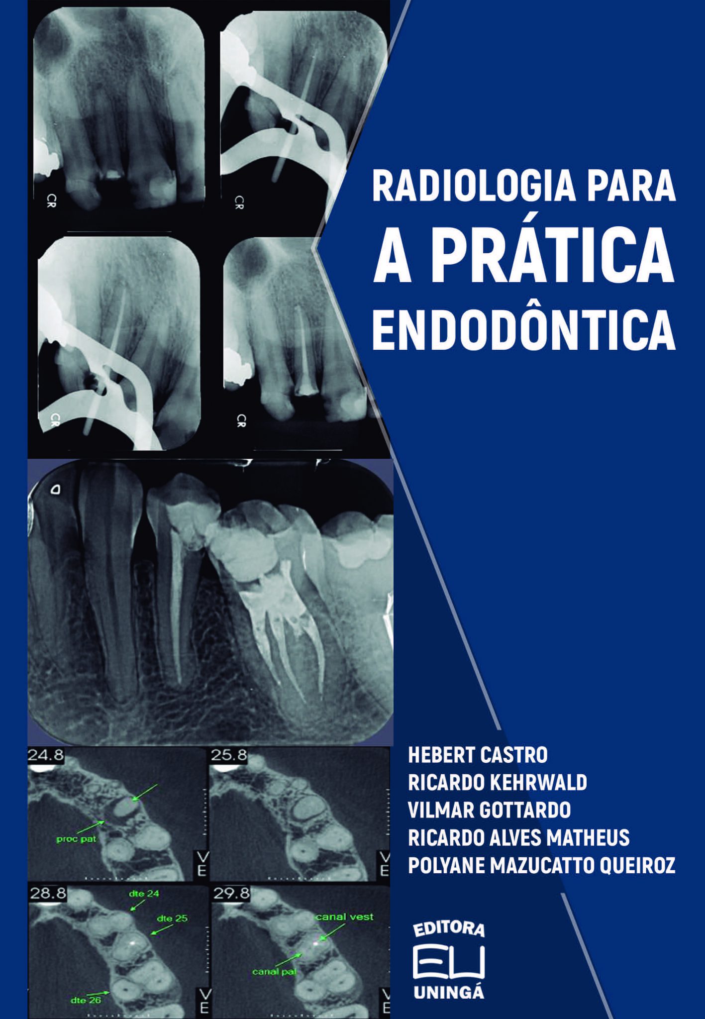 Radiologia Para A Prática Endodôntica - Uningá